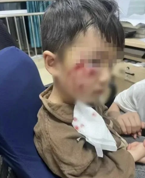 被瘋?cè)麤](méi)有“救命藥”，怎么辦？